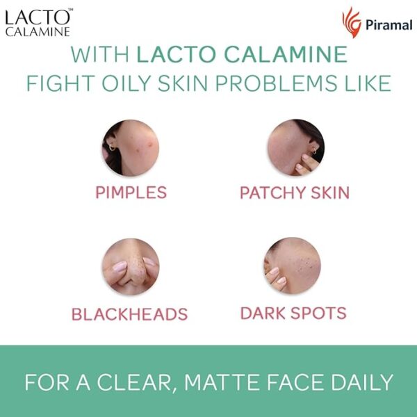Lacto Calamine Face Lotion | 120ml | Daily Moisturizer For Face - Combination To Normal Skin | Kaolin Clay & Aloe Vera | Abosrbs Excess Oil | Fights Pimples, Darkspots & Blackheads | Body Lotion - Image 3