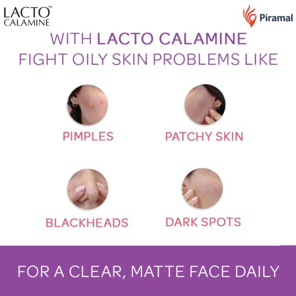 Lacto Calamine Face Lotion | 120ml | Daily Moisturizer For Face - Combination To Normal Skin | Kaolin Clay & Aloe Vera | Abosrbs Excess Oil | Fights Pimples, Darkspots & Blackheads | - Image 4